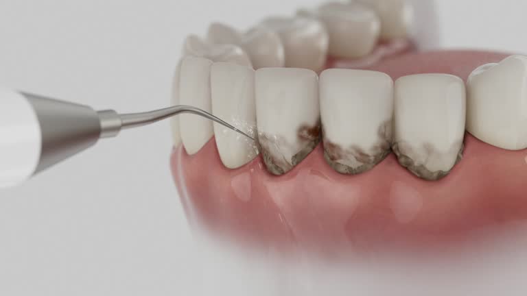 Reliable Tooth Extraction contractor in Red Wing, MN by Smile Center Dentistry